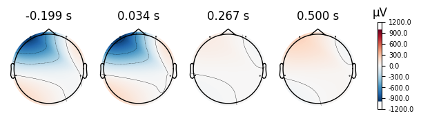 <MNEFigure size 600x220 with 5 Axes>