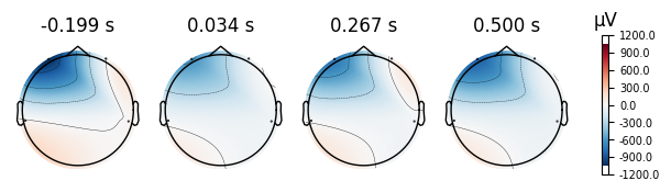 <MNEFigure size 600x220 with 5 Axes>